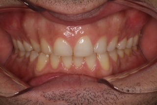 Patient smile after treatment