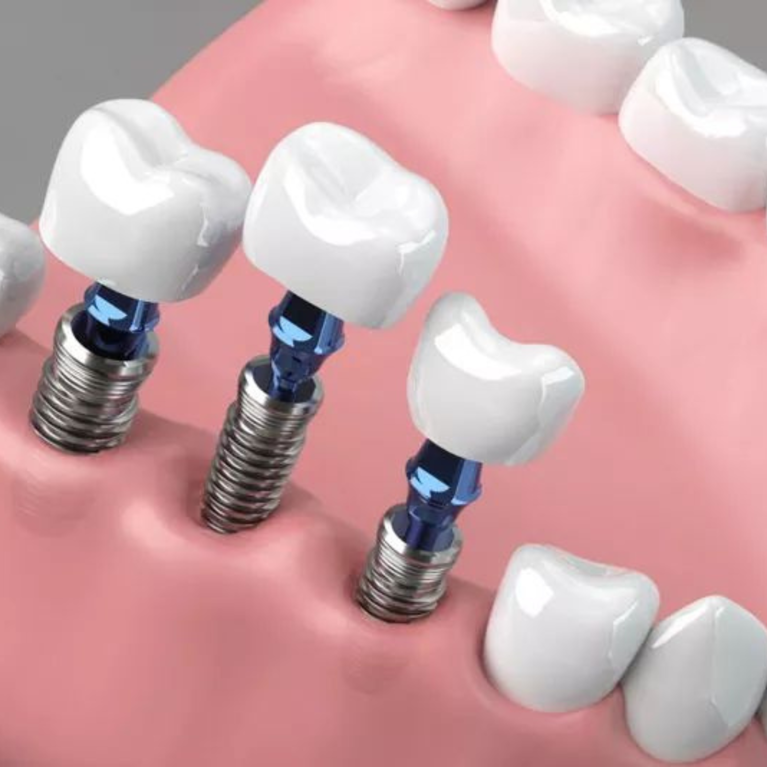 Untitled design (70)